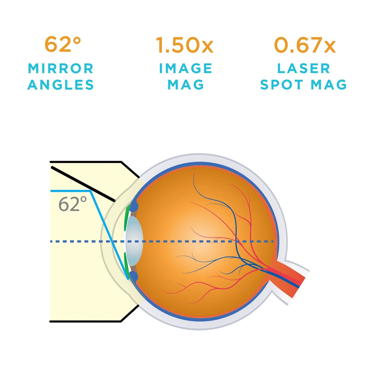 Volk G-1 Gonio Lens - With Flange (VG1)