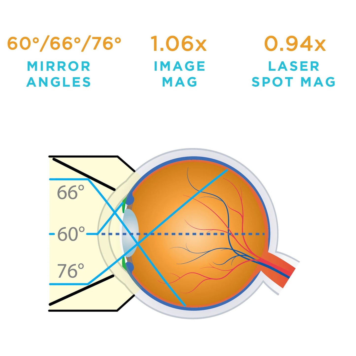 Volk G-3 Gonio Lens - With Flange (VG3)